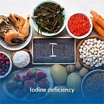 Iodine deficiency