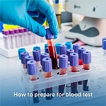 How to prepare for blood test