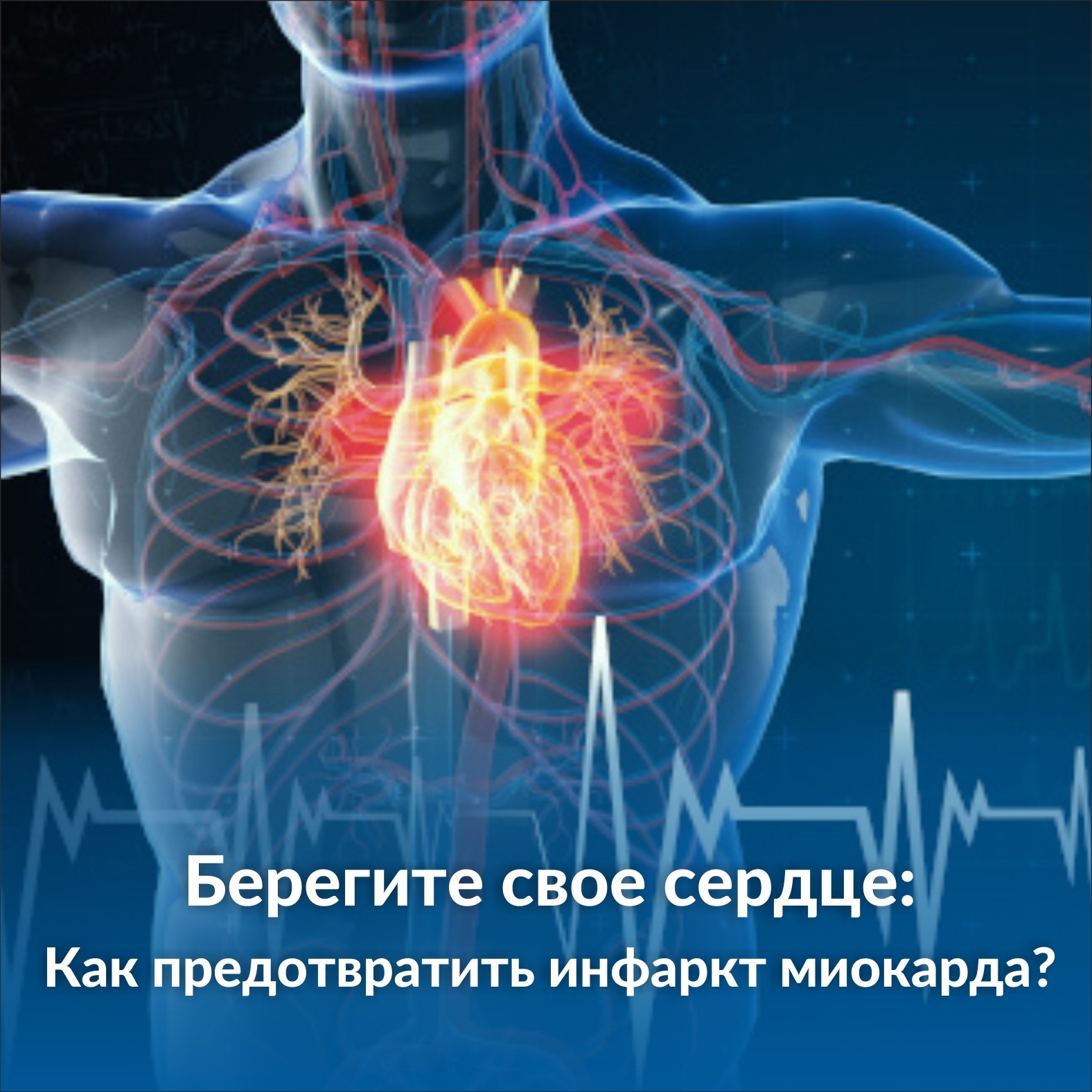«Берегите свое сердце: Как предотвратить инфаркт миокарда?»