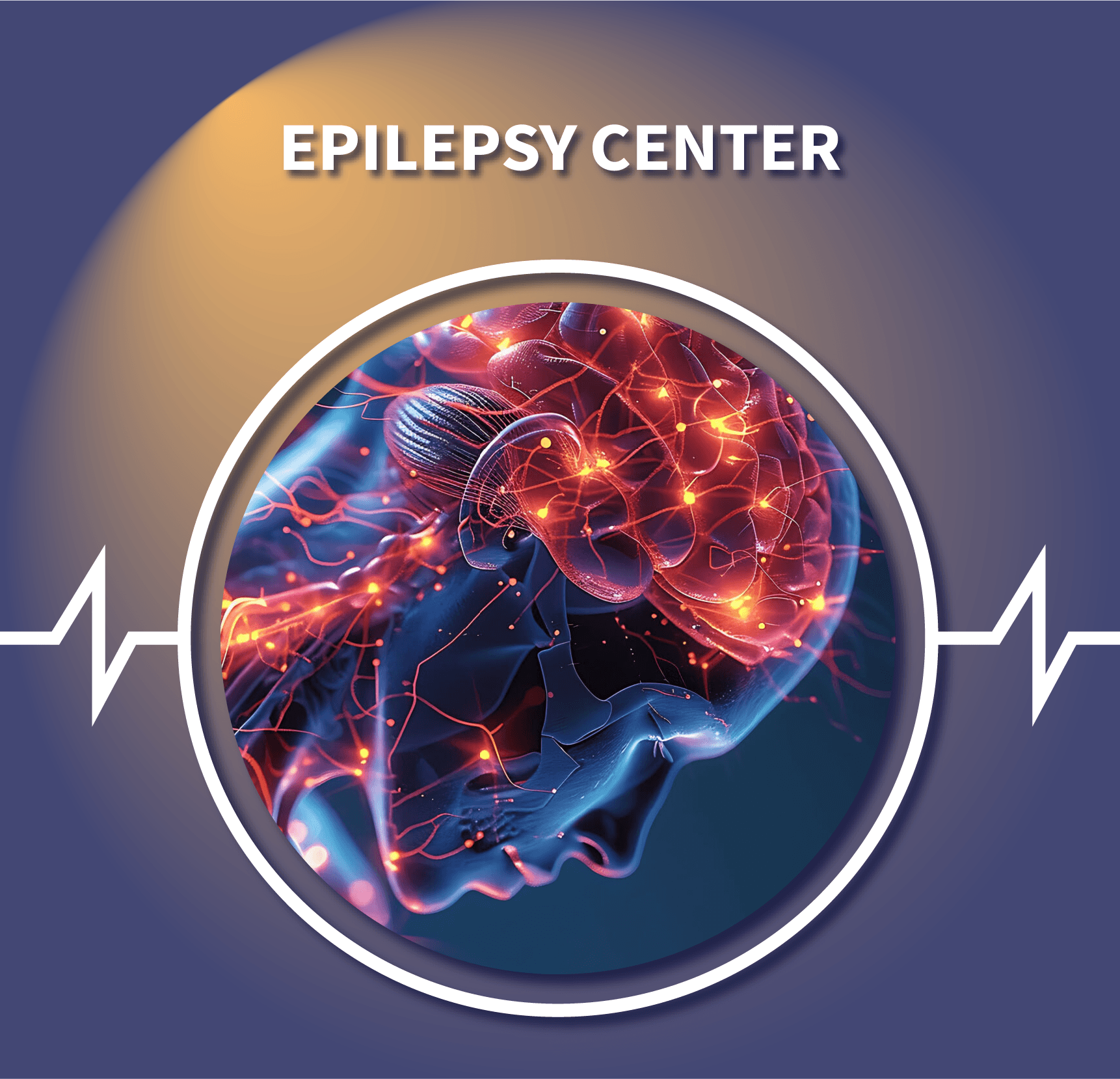 Epilepsy Center